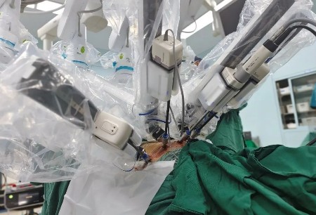 浙大一院完成国内首例国产4臂腔镜机器人全腔内根治性膀胱切除术+原位新膀胱术